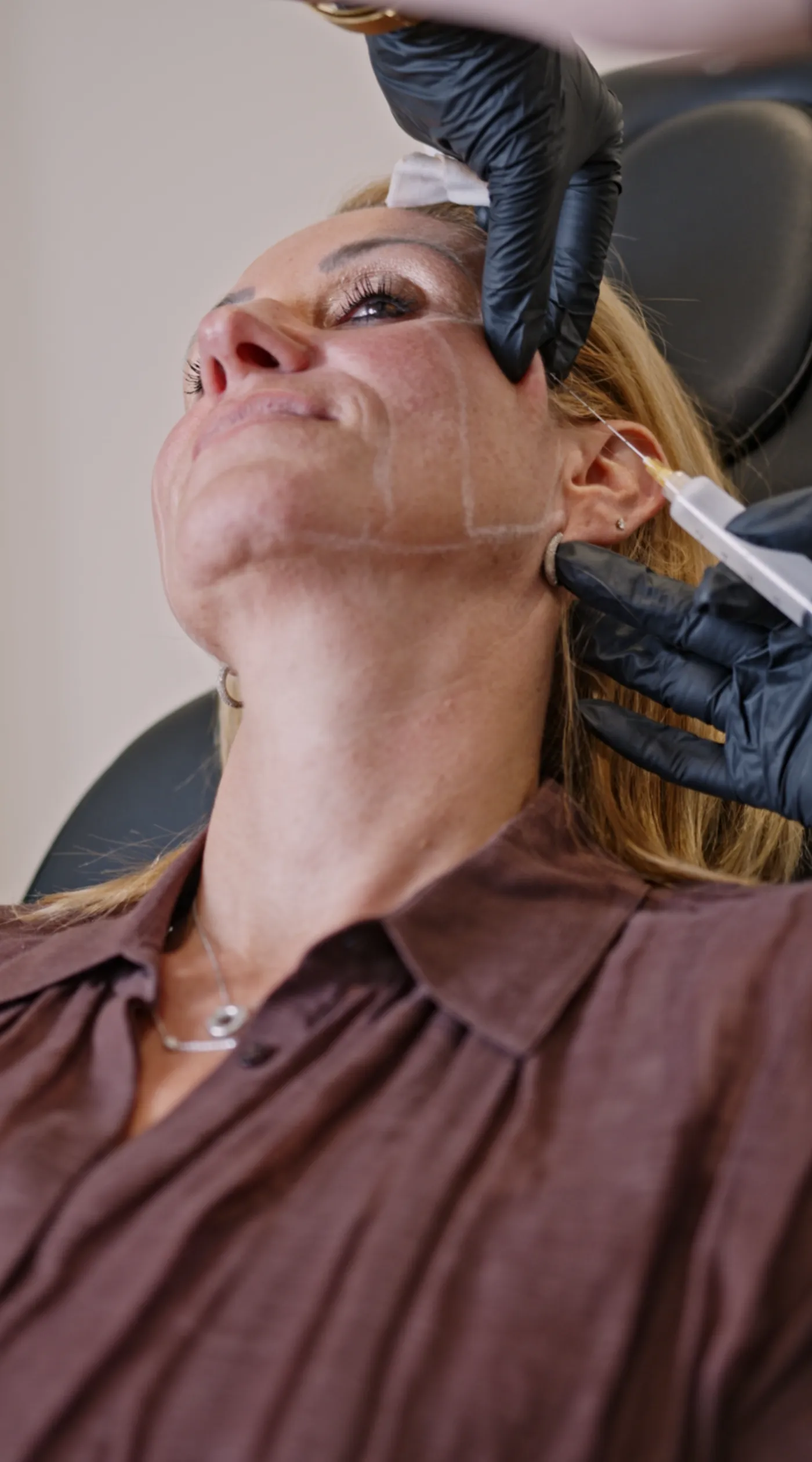 Soin du visage en clinique esthétique